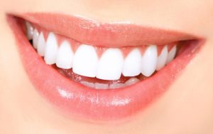 Complete Guide to Teeth Whitening